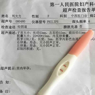 ΢�����ˈDƬ֮�Йz���D��Ч��